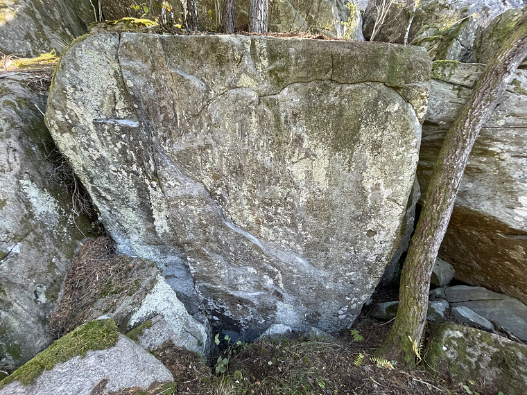 Cutis verticis gyrata